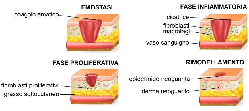 Chirurgia Plastica Frenello | Come eliminare le cicatrici, anche quelle ipertrofiche