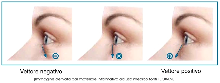 Chirurgia Plastica Frenello | Come riportare vivacità ad uno sguardo spento