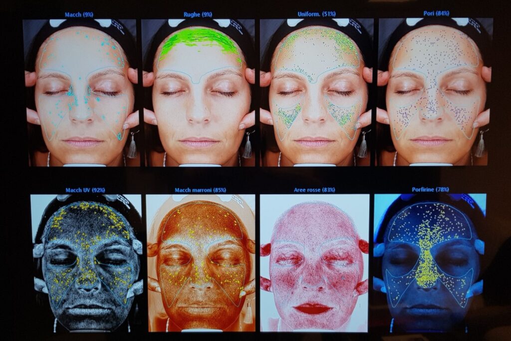 Chirurgia Plastica Frenello | VISIA: Imaging ed analisi del viso