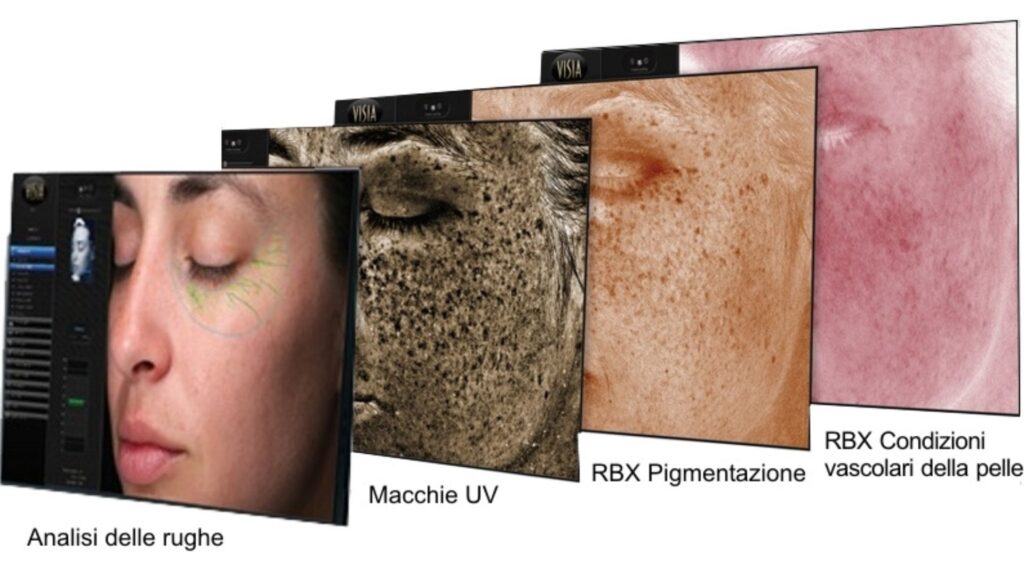 Chirurgia Plastica Frenello | VISIA: Imaging ed analisi del viso
