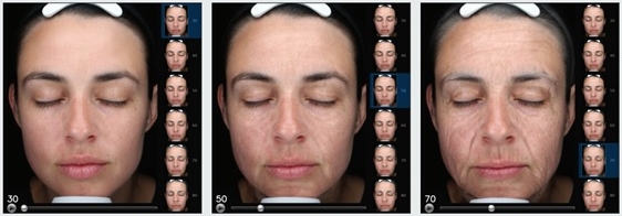 Chirurgia Plastica Frenello | VISIA: Imaging ed analisi del viso