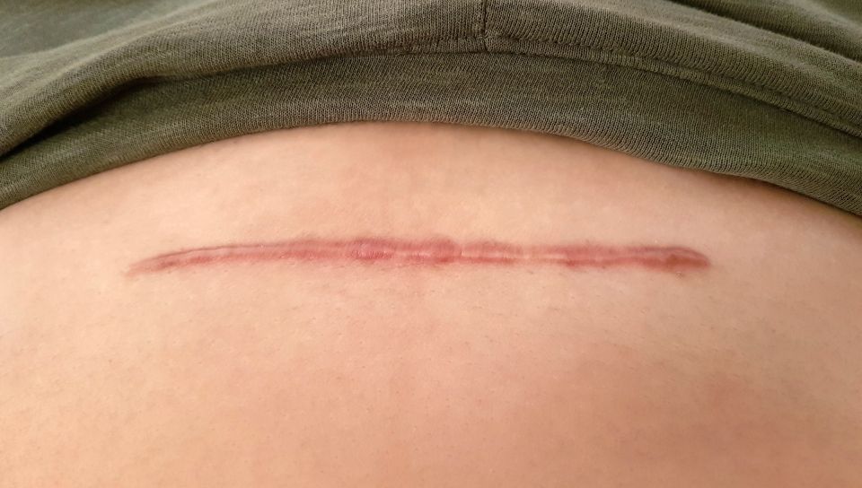 Chirurgia Plastica Frenello|Dermato chirurgia ambulatoriale