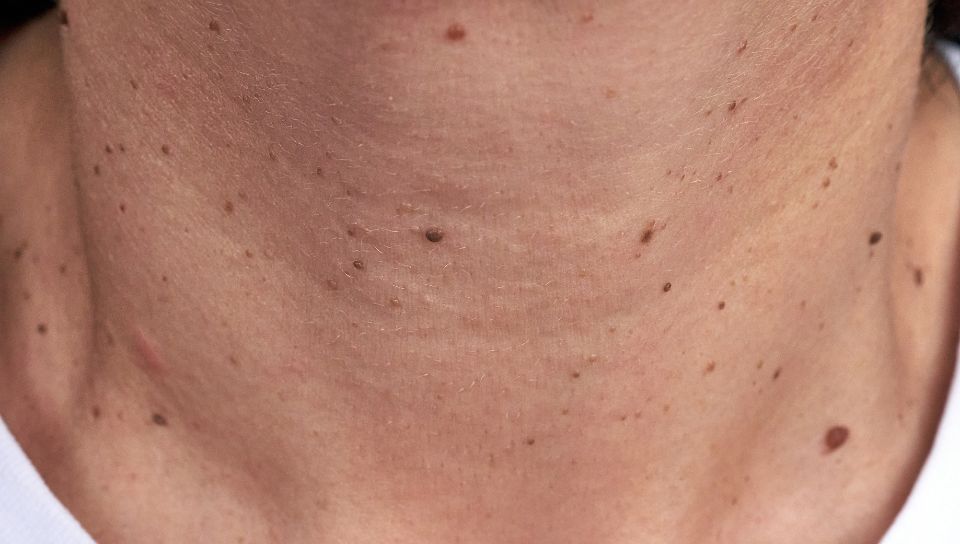 Chirurgia Plastica Frenello|Dermato chirurgia Laser