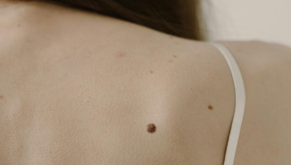 Chirurgia Plastica Frenello|Dermato chirurgia ambulatoriale