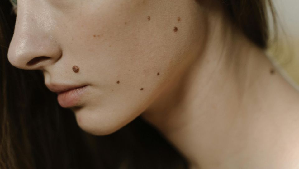 Chirurgia Plastica Frenello|Dermato chirurgia Laser