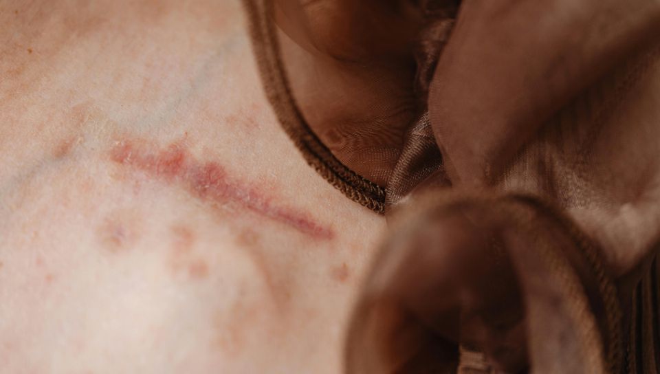 Chirurgia Plastica Frenello|Dermato chirurgia ambulatoriale